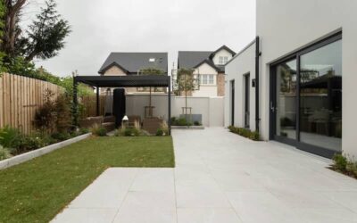 Which Detached Structure is Best for Your Yard?